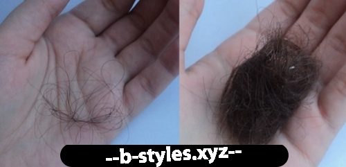 Норма випадання волосся в день при митті і розчісуванні